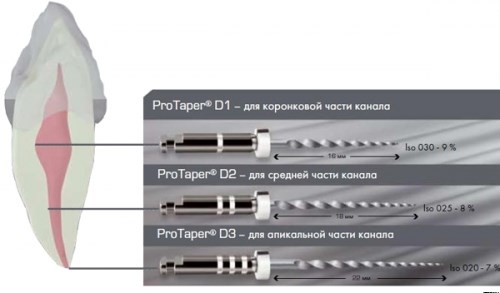 ProTaper Retreatment  D3 (6 шт.)- для распломбировки каналов 00000909829 - фото 331644