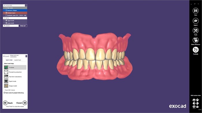 Модуль Exocad Full Denture Module. Модуль полносъемных протезов FullDentureModule - фото 360612