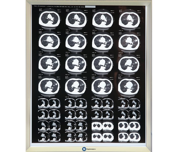 НПК Негатоскоп.Ру однокадровый LED (светодиодный) негатоскоп FRAME1 - фото 502529