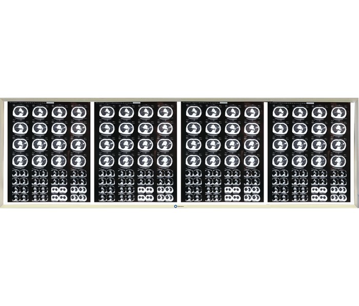 НПК Негатоскоп.Ру четырехкадровый LED (светодиодный) негатоскоп FRAME4 - фото 502530