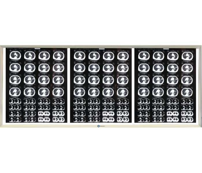 НПК Негатоскоп.Ру трехкадровый LED (светодиодный) негатоскоп FRAME3 - фото 502531