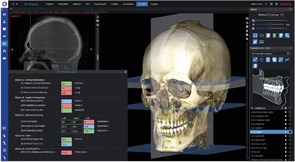Программное обеспечение Planmeca Romexis 3D Cephalometric Analysis, лицензия на 1 пользователя FE004915