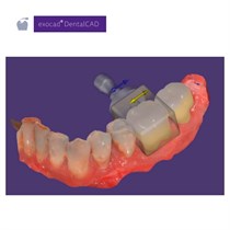 Обновления программного обеспечения для Exocad, модуль nesting (включая In-CAD Nesting) 265318