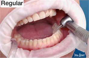 OptraGate  Regular стандартные, 1шт.,  Ivoclar. 1231910869