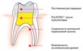 Pulpotec, PD 00000002483 - фото 320522