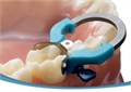 PALODENT PLUS V3 Starter Kit-Матрицы Набор (20 матриц -15 х 5,5мм, 5х 4,5 мм, 15 клиньев,2 кольца,щипцы,пинцет) 1231911234 - фото 321137