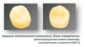 AHfil LC цв.А2 - Цемент светоотверждаемый стеклоиномерный для реставраций (15г пор., 6мл жид.) 1231912814 - фото 325495