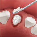 Костный материал OsteoBiol Apatos Cortical, гранулы,1 гр, размер гранул 0.6-1.0 мм из кортикальной кости без коллагена. AC1010FS - фото 352565