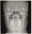 Ортопантомограф KAVO 2D DEXIS OP 3D Pro Pan с цефалостатом 0.805.5200 - фото 356705