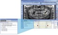 Томограф Planmeca ProMax 3Ds (FOV 9х8) 10020018 - фото 357981