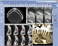 Томограф Planmeca ProMax 3Ds (FOV 9х8) 10020018 - фото 357988