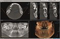 Томограф Orthopantomograph KAVO 3D Pro Small Panel (6 x 4, 6 x 8) CEPH. 0.805.5400 - фото 358028