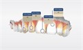 Сканер интраоральный SIRONA CEREC Omnicam AF 2.0 6564715 - фото 360402