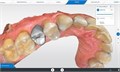 Сканер интраоральный SIRONA CEREC Omnicam AF 2.0 6564715 - фото 360403