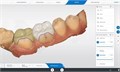 Сканер интраоральный SIRONA CEREC Omnicam AF 2.0 6564715 - фото 360406