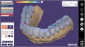 Модуль Exocad Bite splint module. Модуль шинирования зубов bitesplintmodu - фото 360539