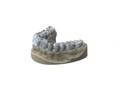 Модуль Exocad Bite splint module. Модуль шинирования зубов bitesplintmodu - фото 360540