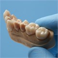 Фотополимер Formlabs Permanent Crown Resin A2 (Dental only) (для изготовления постоянных коронок) st780909 - фото 360894