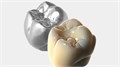 Модуль Exocad Trusmile. Модуль для естественной визуализации реставраций Trusmile - фото 361039