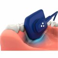 Радиовизиограф EzSensor Soft EzSensor-Soft - фото 377842