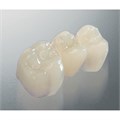 Tempofit regular - материал для изготовления временных коронок и мостов 1:1, А1 03531 - фото 387179