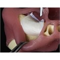 СONTUR  Membrane 15х20 - мембрана коллагеновая (резорбируемая двухслойная) MBC-15 - фото 388252