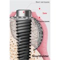SmartBuilder - мембрана SM1, P 4,BW 8,BL 7,BD 5.5 SM1W487SB - фото 388937