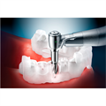 OneGuide Kit - набор для навигационной хирургии Osstem OOGK - фото 390384