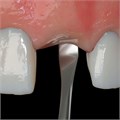 Долото PM Edge Crestal Bone Chisel PMEDGES - фото 393377