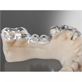 3D материал Freeprint ortho 385 - для моделирования, прозрачный, 1 кг 3989 - фото 401219