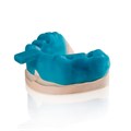 VarseoWax Tray - смола для 3D-печати индивидуальных оттискных лотков, 1 кг 41013 - фото 401244
