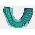Exocad - модуль Extramodul Zebris/Jaw Motion Import 265218 - фото 401348