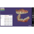 Exocad - модуль Extramodul Zebris/Jaw Motion Import 265218 - фото 401350