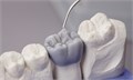 Renfert GEO Crowax - воск зеленый, моделировочный, прозрачный, среднетвёрдый, 80 г 475-0100 - фото 440755
