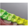 Greenbite colour материал для регистрации прикуса (2х50мл), Detax (Германия) 0001914449 - фото 448150
