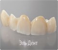 Tempofit semi A2, 10:1 (75 г) композитный материал для изготовления временных коронок и мостов, Detax (Германия) 1231918126 - фото 450890