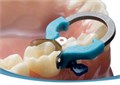 PALODENT PLUS V3 Starter Kit-Матрицы Набор (20 матриц -15 х 5,5мм, 5х 4,5 мм, 15 клиньев,2 кольца,щипцы,пинцет) 1231911234 - фото 455203
