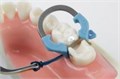 PALODENT V3 Матрицы 5.5 мм 50 шт 659730V 1231910906 - фото 455253