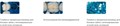 2776 Blue Lucifix Molar Matries - голубые матрицы для моляров Kerr 0001911752 - фото 455389