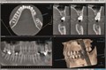 Ортопантомограф KAVO 2D DEXIS OP 3D Pro Pan 0.805.5100 - фото 475527