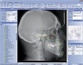 Ортопантомограф Planmeca ProOne 30010469 - фото 476553
