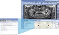 Томограф Planmeca ProMax 3Ds (FOV 9х8) 10020018 - фото 476742