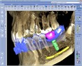 Томограф Planmeca ProMax 3D Mid без цефалостата 10026081 - фото 476807