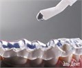 Glassbite Standart packing (Гассбайт) - Масса для регистрации прикуса прозрачная база+кат50 мл, смес.зел., Detax (Германия) 0001913002 - фото 492972