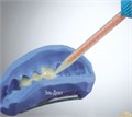 Tempofit premium A3, 10:1 (75 г) композитный материал для изготовления временных коронок и мостов, Detax (Германия) 1231918123 - фото 493201