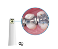 Durr Dental VistaCam IX - интраоральная видеокамера с головками Cam, Proof, Proxi 2108-05 - фото 495596