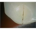 Durr Dental VistaCam IX - интраоральная видеокамера с головкой Cam 2108-02 - фото 495605