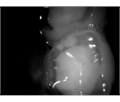 Durr Dental VistaCam IX - интраоральная видеокамера с головками Cam, Proof 2108-01 - фото 495621