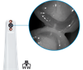 Durr Dental VistaCam IX - интраоральная видеокамера с головками Cam, Proxi 2108-06 - фото 495680