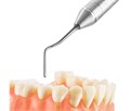 Fabri 1304-1,0F Black - удлиненная узкая гладилка с штопфером-шариком Ø1.0mm, эргономичная ручка Ø10mm, покрытие Black 1304-1,0F Black - фото 496685